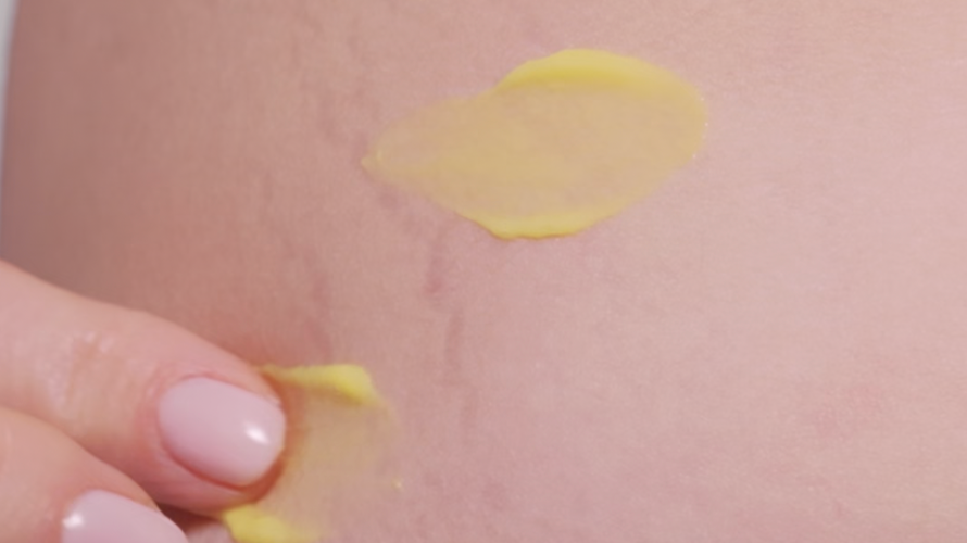 Jak stosować Krem ze stabilną formą retinalu FACE&BODY RetinALL 0,05% na CIAŁO i ŚWIEŻE ROZSTĘPY. Pierwsze wskazówki